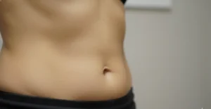 ¿Qué es la flacidez? Tipos, síntomas, causas y grados